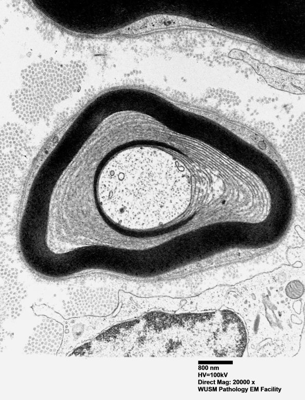 2C2 POEMS (Case 2) EM 018 - Copy