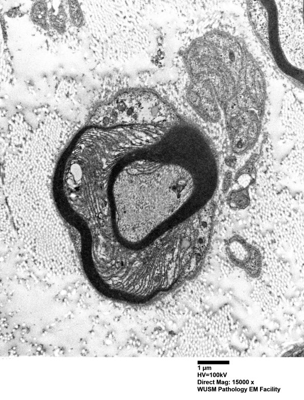 3A1 POEMS (Case 3) EM 016 - Copy