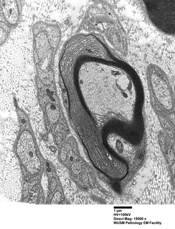 3A2A (Case 3) EM 026 - Copy