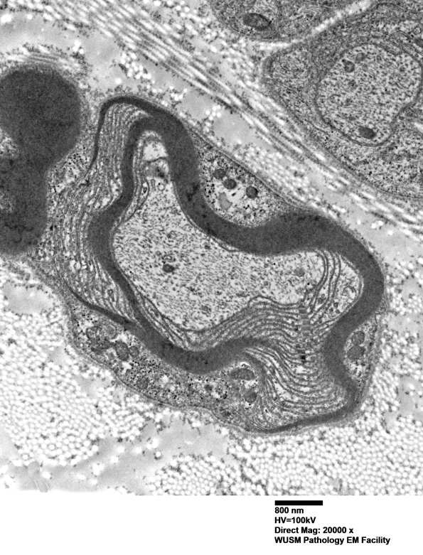 3A3A POEMS (Case 3) EM 002 - Copy