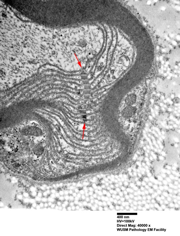 3A3B POEMS (Case 3) EM 002 - Copy