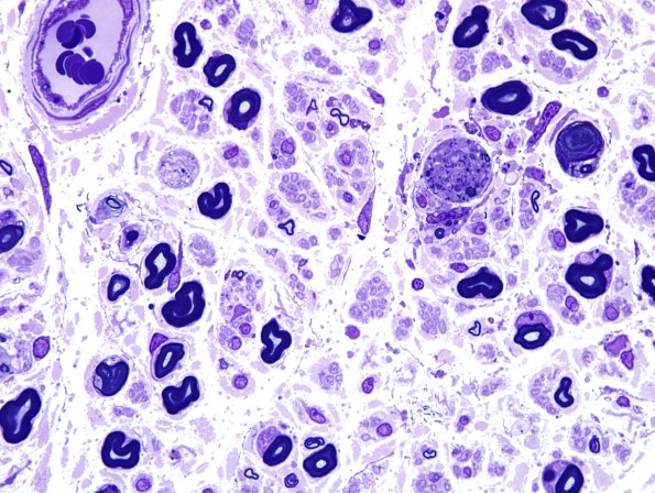 4A4 POEMS (Case 4) Plastic 100X 1.jpg