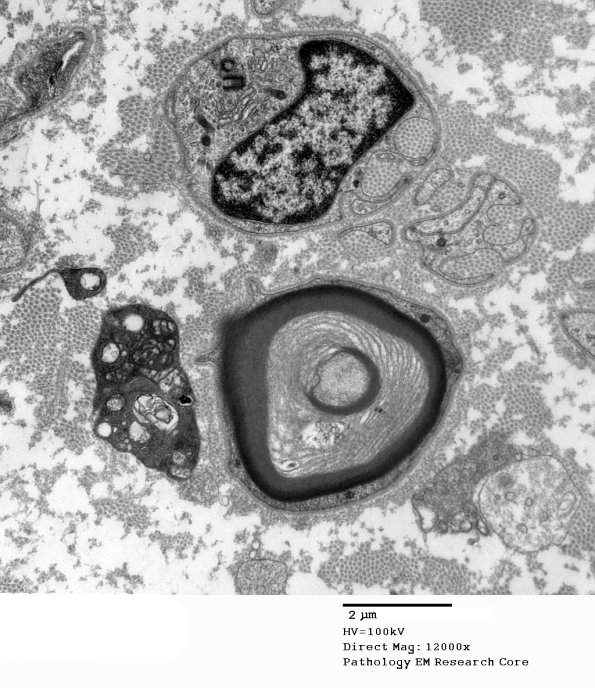 4B1A POEMS (Case 4) 019A - Copy