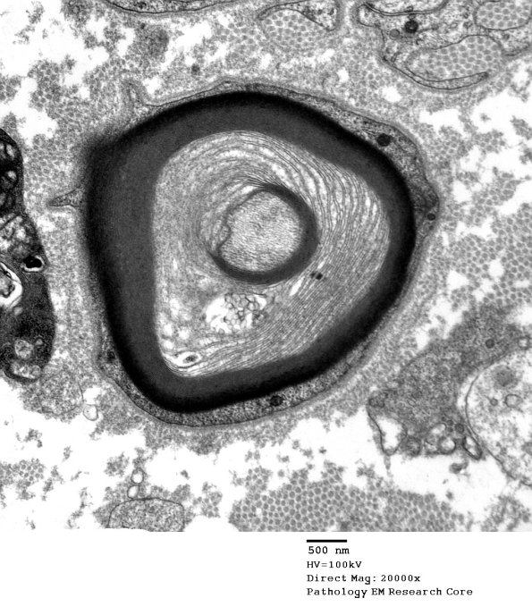 4B1B POEMS (Case 4) 020A - Copy
