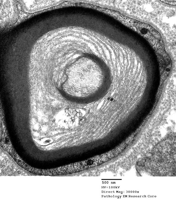4B1C POEMS (Case 4) 023 - Copy
