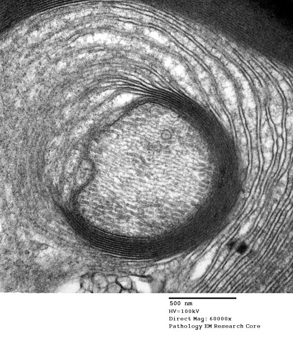 4B1D POEMS (Case 4) 026A - Copy