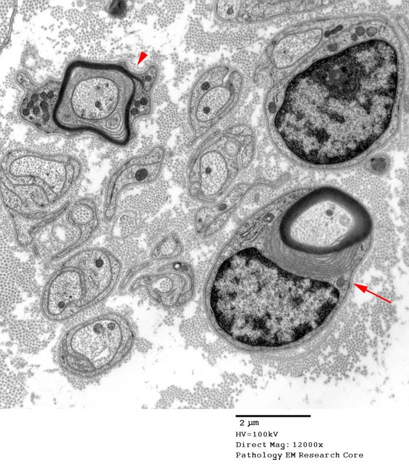 4B2A POEMS (Case 4) 005A copy - Copy