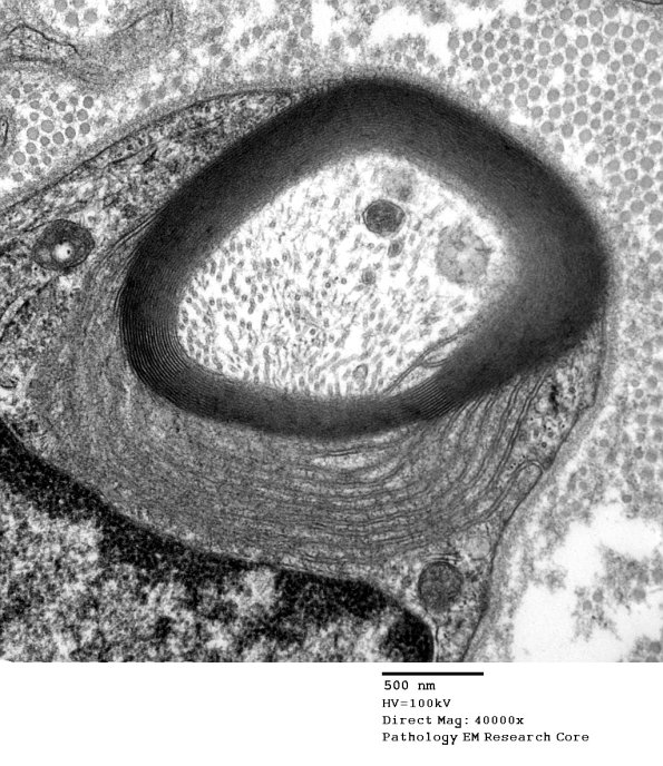 4B2C POEMS (Case 4) 008 - Copy