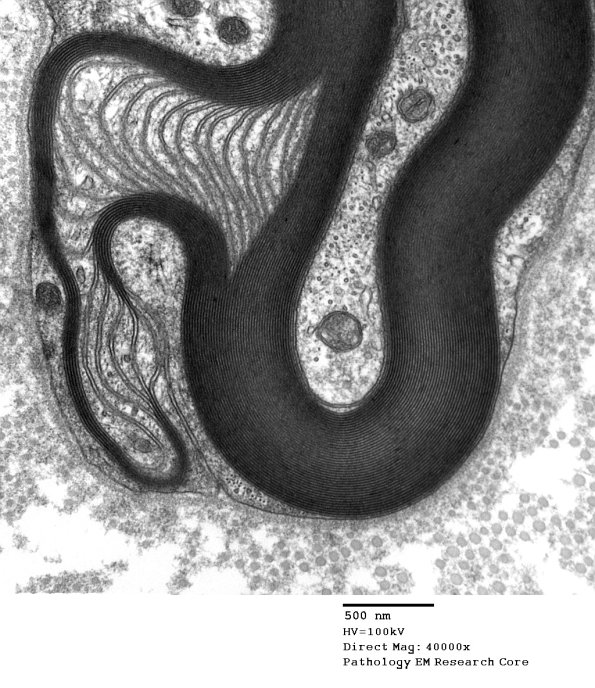 4C2B POEMS vs S-L Cleft (Case 4) 013 - Copy