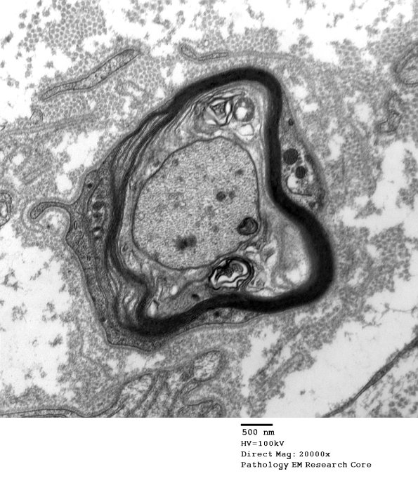 4C3 POEMS (Case 4) 003a NEAR NODE - Copy