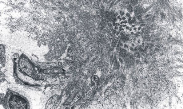 10C (Case 10) EM 1 - Copy