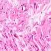1A4 Amyloid (Case 1) H&E 40X 1 copy