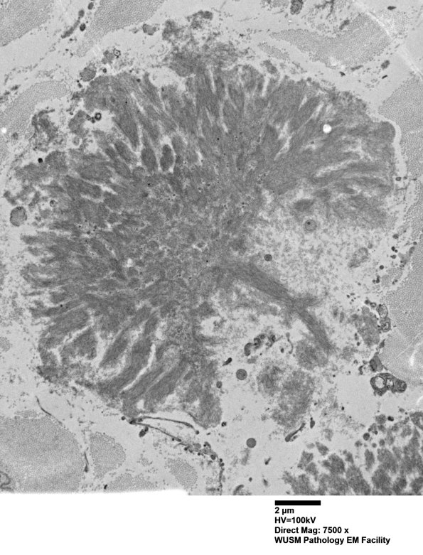 1F10 (Case 1) Nerve_053 - Copy