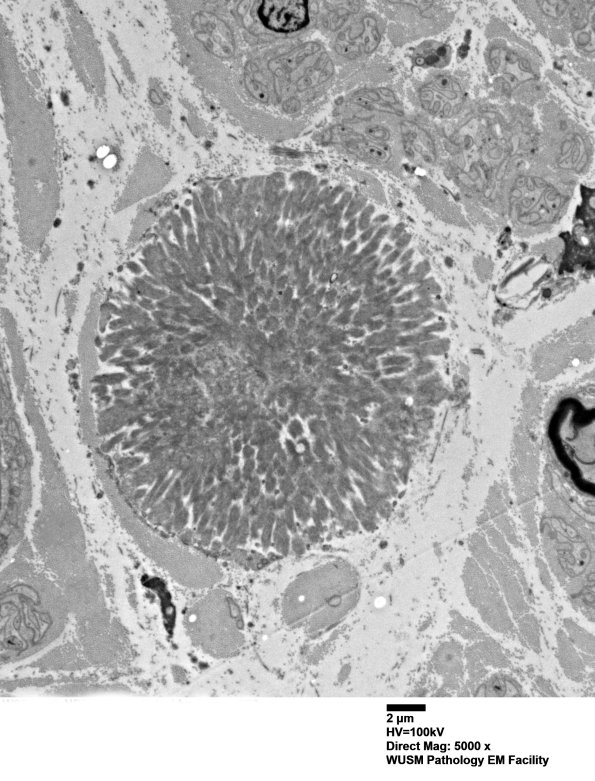 1F4 (Case 1) Nerve_073 - Copy