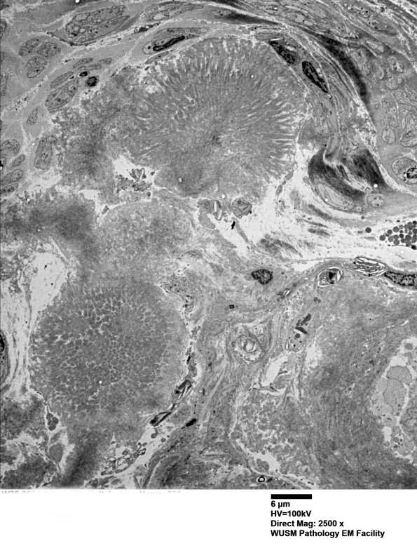 1F7 (Case 1) Nerve_030 - Copy