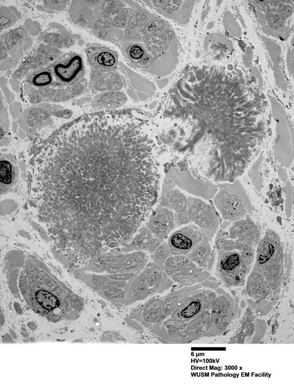 1F9 (Case 1) Nerve_067 - Copy