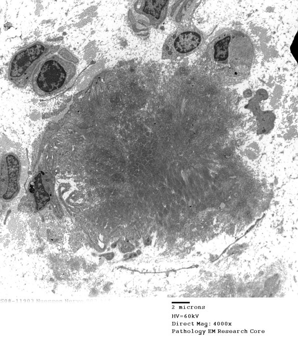 2F1 (Case 2) EM002 - Copy