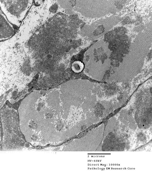 2F10 (Case 2) EM027 - Copy