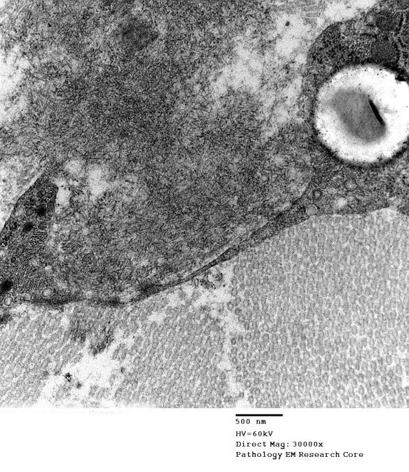 2F11 (Case 2) EM028 - Copy