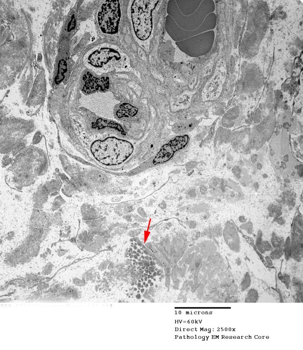 2F12 (Case 2) EM036 copy - Copy