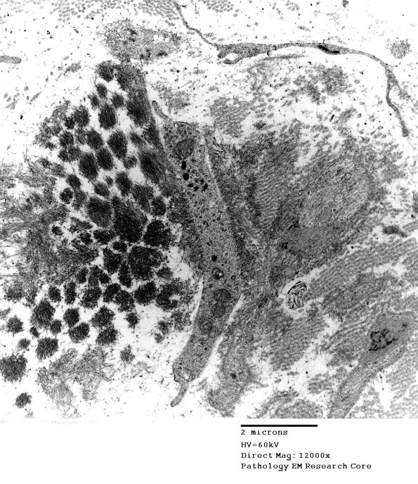 2F13 (Case 2) EM038 - Copy
