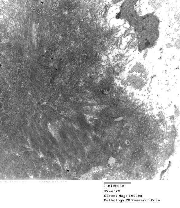 2F2 (Case 2) EM016 - Copy
