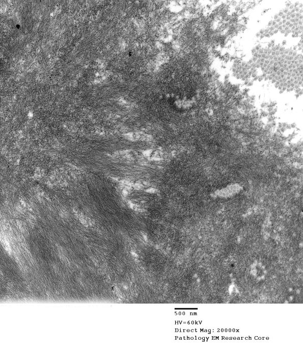 2F3 (Case 2) EM018 - Copy