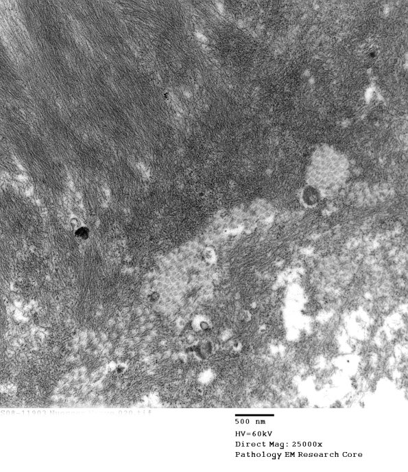 2F5 (Case 2) EM020 - Copy