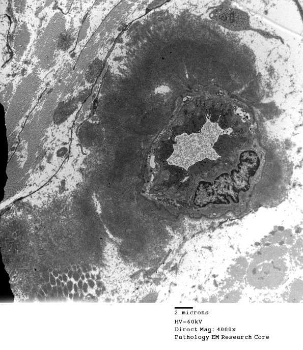 2F6 (Case 2) EM021 - Copy