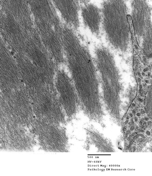 2F8 (Case 2) EM023 - Copy