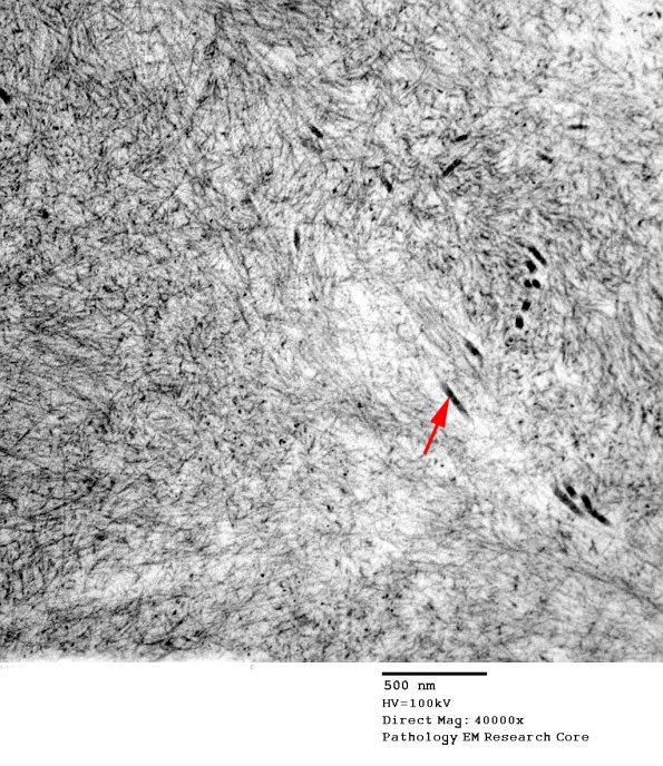 7E2 (Case 7)  EM 026A copy - Copy