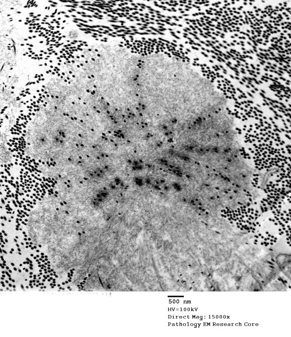 7E3 (Case 7) EM 036A - Copy
