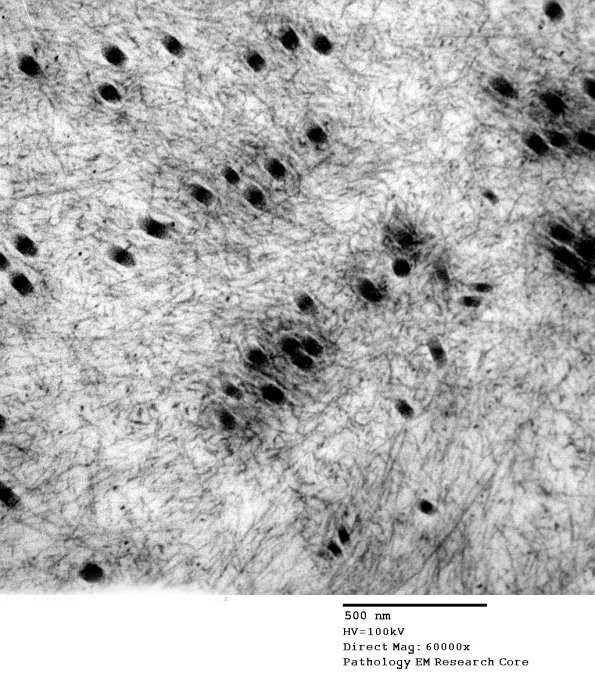 7E4 (Case 7) EM 040A - Copy
