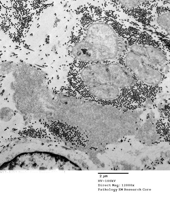 7E5 (Case 7) 009 - Copy
