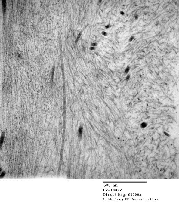 7E6 (Case 7) 016 - Copy