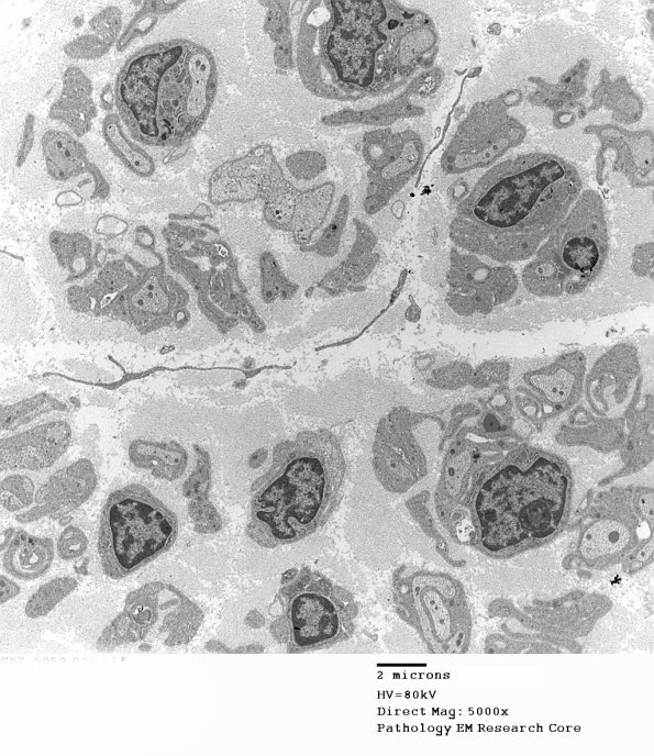 8D1 (Case 8) EM026 - Copy