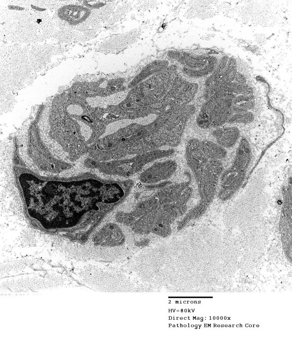 8D2 (Case 8) EM002 - Copy
