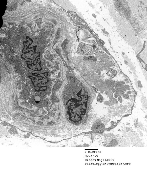 8D4 (Case 8) EM017 - Copy