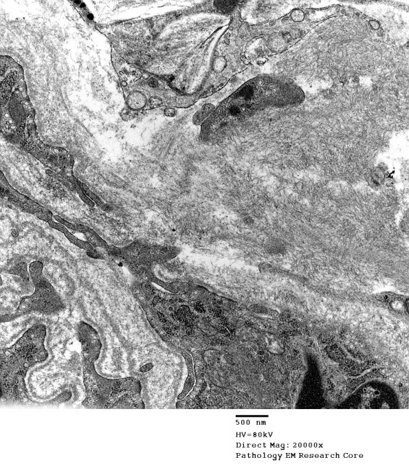 8D6 (Case 8) EM019 - Copy