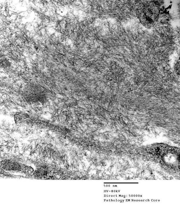 8D7 (Case 8) EM012 - Copy