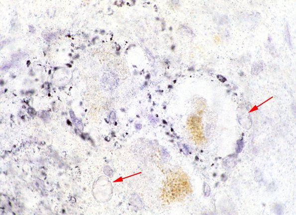 11B Human SubP 1 copy
