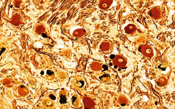 2A10 BK13-7 112M 40X