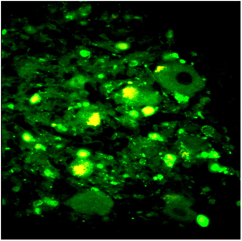 8A2 Human NPY 2A SMG