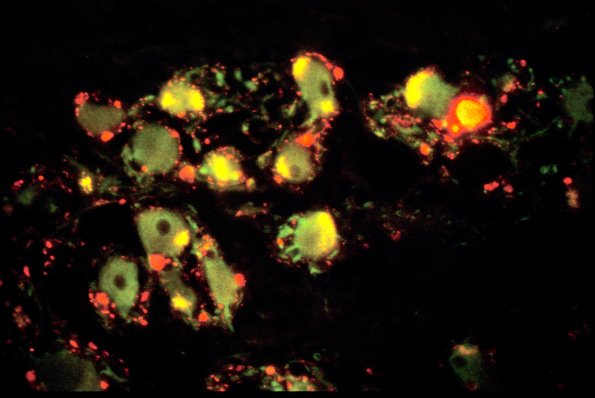 9B1 NPY red RMd020 Green