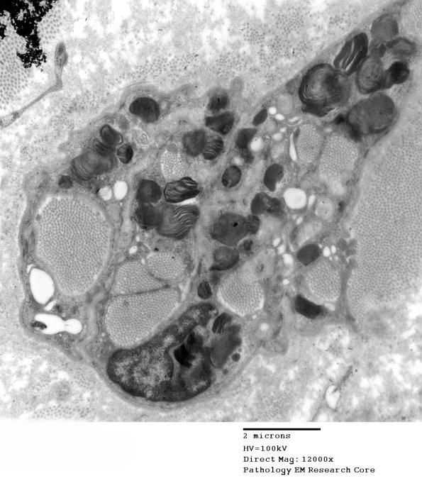1B2 Fabry's Dz_017 - Copy