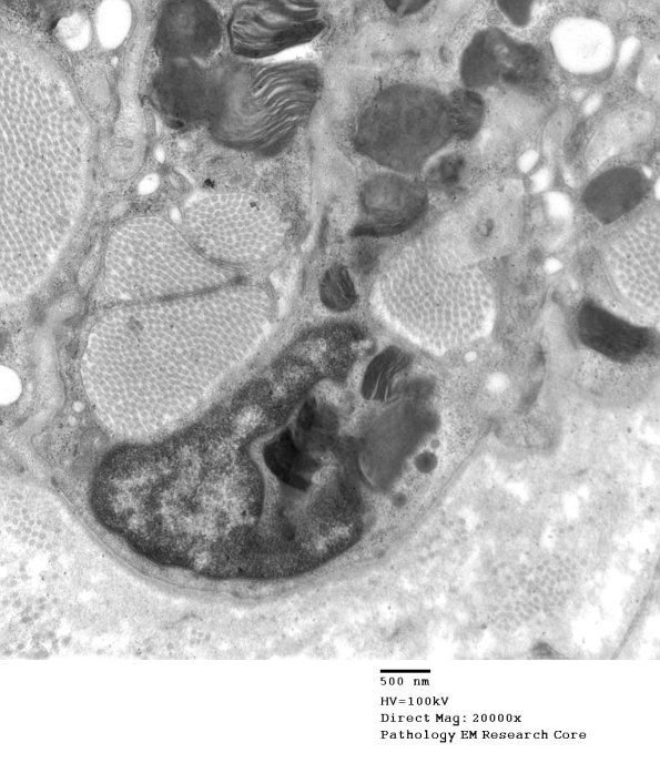 1B3 Fabry's Dz_011 - Copy