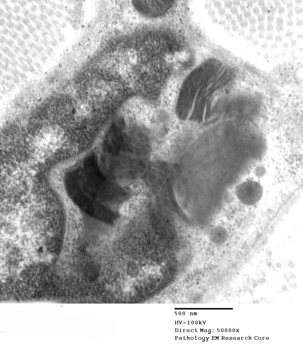 1B4 Fabry's Dz_013 - Copy