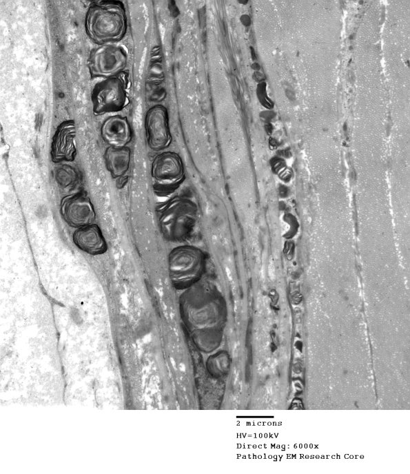 1B6 Fabry's Dz_025 - Copy