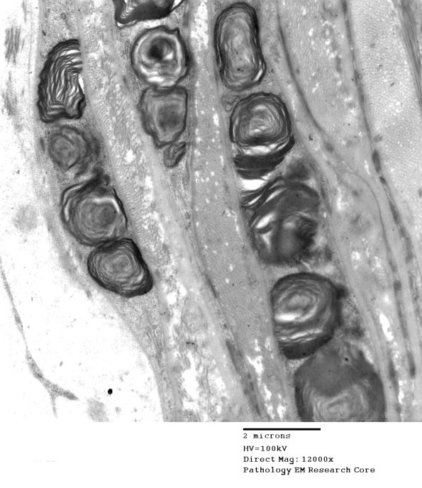 1B7 Fabry's Dz_028 - Copy