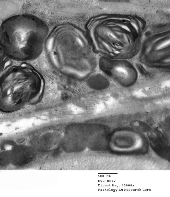 1B8 Fabry's Dz_005 - Copy